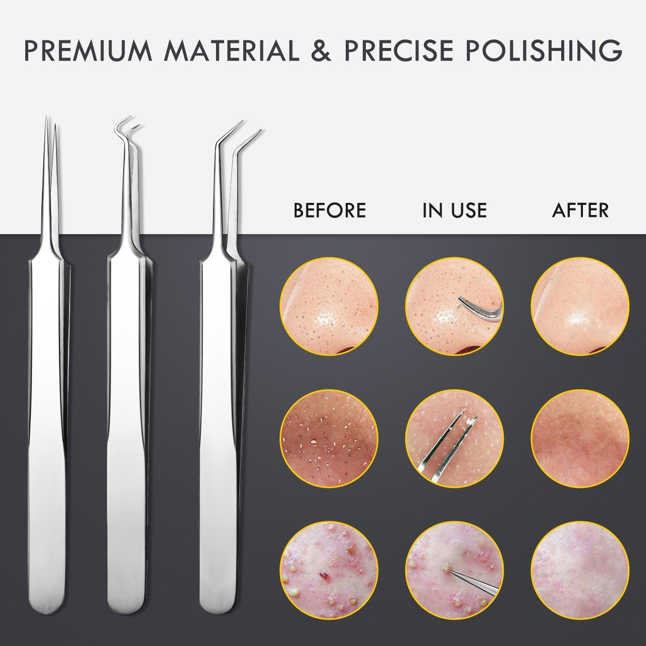 Beauté Secrets 8 Pieces Blackhead Remover Tweezer Kit & Dental Tools, Blackhead Tools