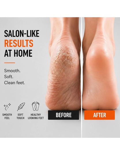 Beauté Secrets Double-Sided Pumice Stone Foot Scrubber with Wooden Handle | Callus Remover for Feet | Dead Skin & Cracked Heel Remover