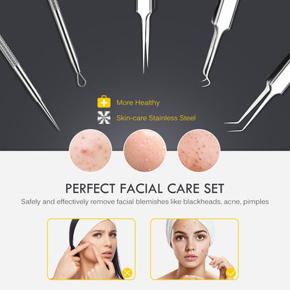 Beauté Secrets 8 Pieces Blackhead Remover Tweezer Kit & Dental Tools, Blackhead Tools